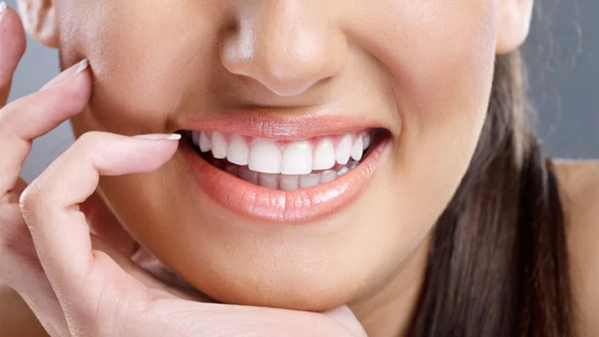 Sorriso estético com dentes alinhados e brancos